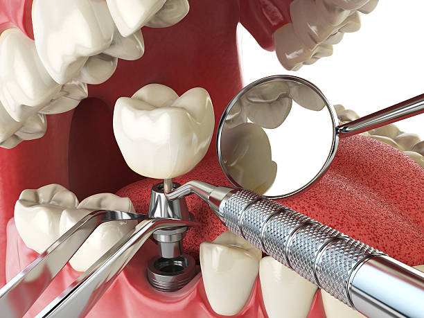 Best Emergency Denture Repair in Tomball, TX